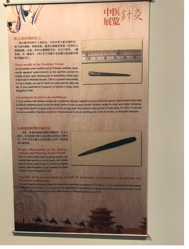 Akupunktur-Poster 4