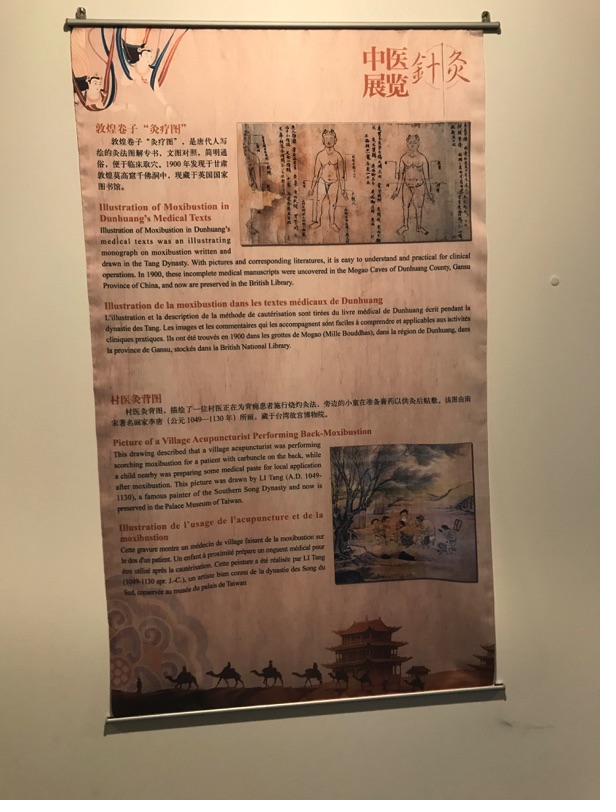 Akupunktur-Poster 21