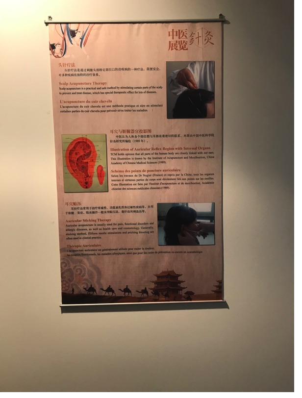 Akupunktur-Poster 24