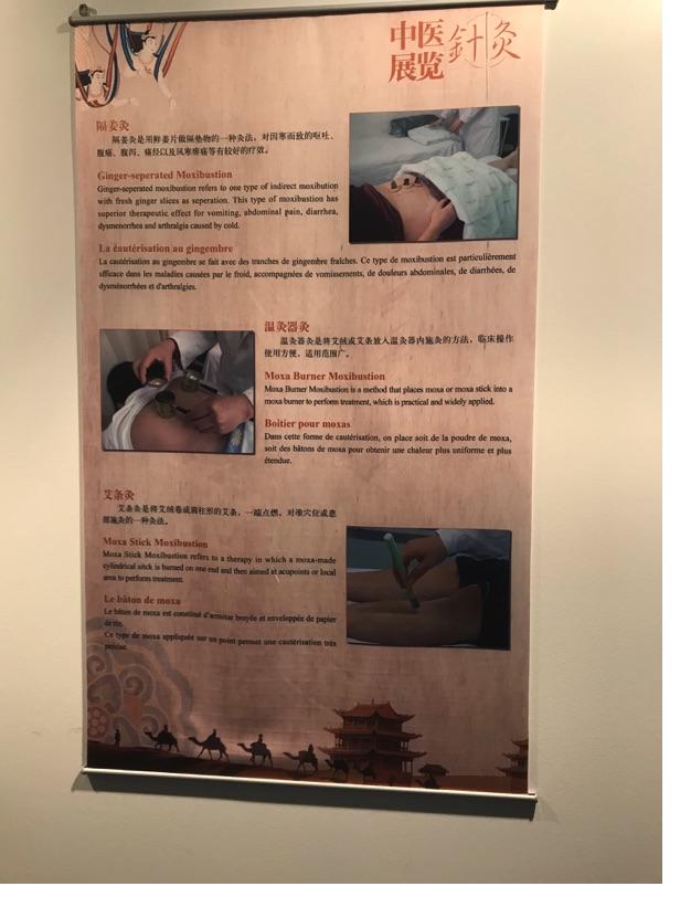 Akupunktur-Poster 25