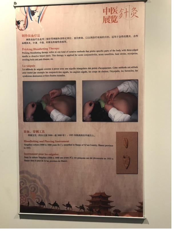 Akupunktur-Poster 28