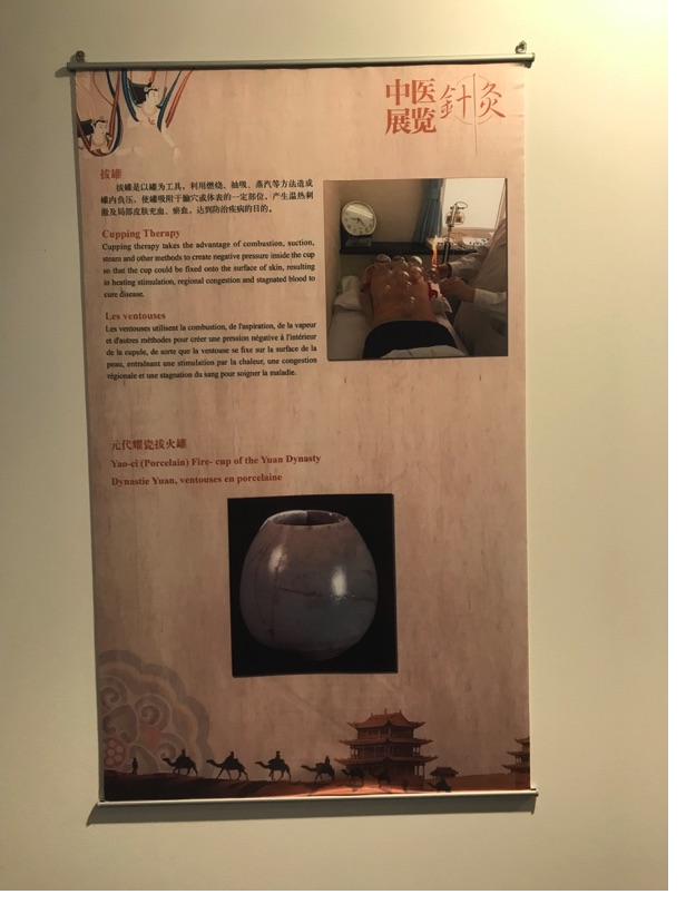 Akupunktur-Poster 29