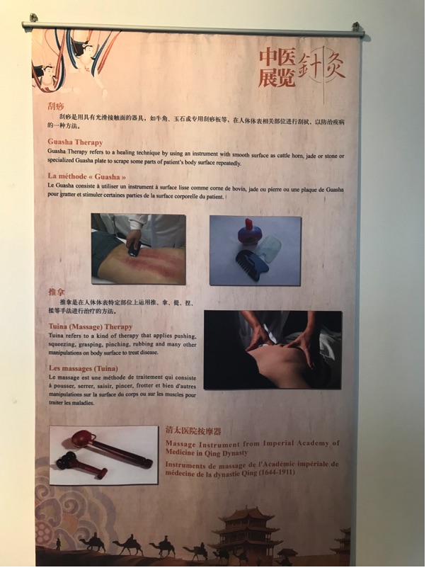 Akupunktur-Poster 30