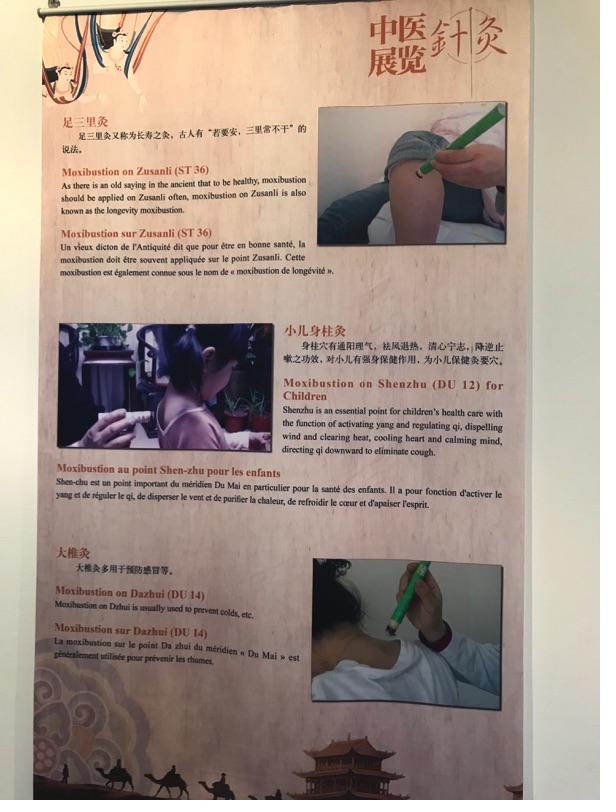 Akupunktur-Poster 33