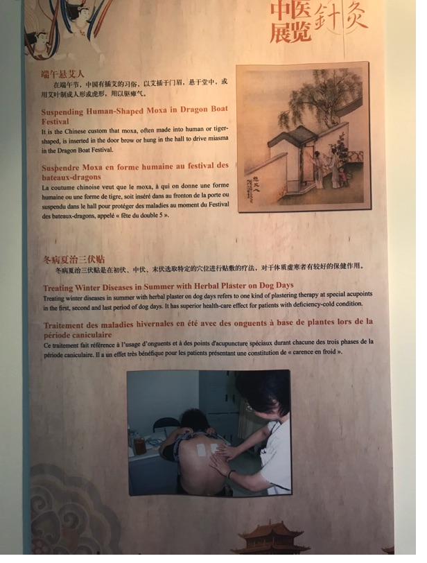 Akupunktur-Poster 34